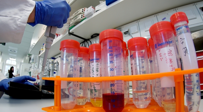 La catena di infezione A. Coronavirus, il peggiore degli incubi per l'Italia: le prospettive del contagio