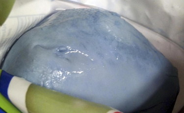 Torino, nuovo allarme per le mozzarelle contaminate