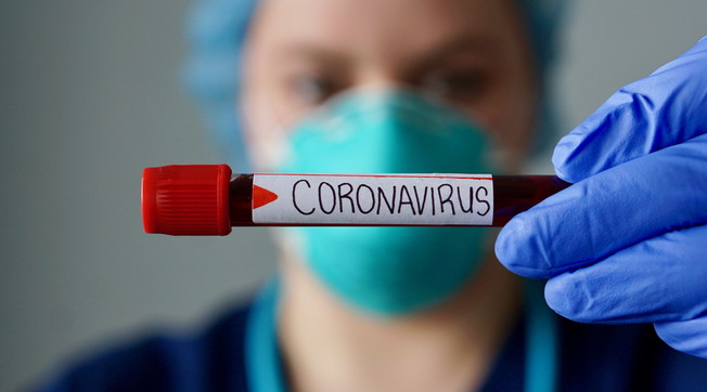 Il 30% ricoverato ancora, il 12% morto. Covid, cinque mesi dopo la guarigione: le cifre di uno studio agghiacciante