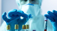 Peggio del virus Ebola. Variante Delta, il peggiore dei report: con cosa abbiamo a che fare