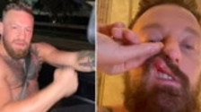 Pugni in faccia, Facchinetti massacrato da McGregor: "Sangue ovunque". Come lo ha ridotto