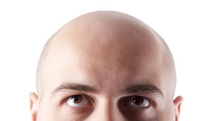 Sei pelato? Molestia sessuale: la sentenza che cambia la storia, ecco cosa si rischia con i calvi