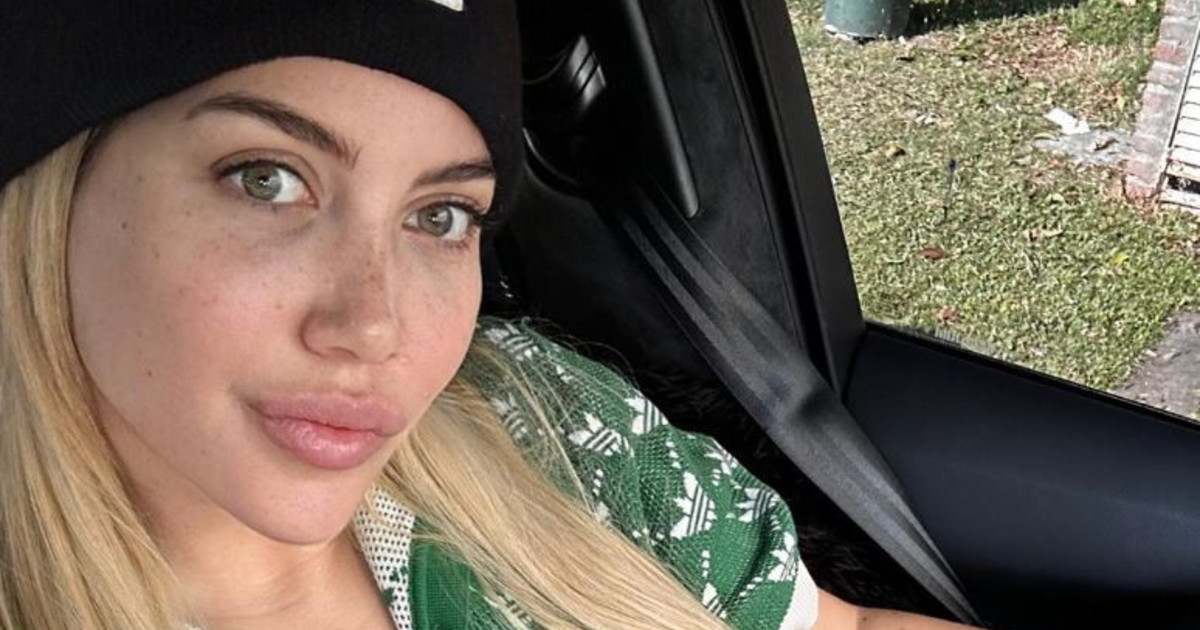 Wanda Nara e la leucemia, tranne stavolta. Le sue prime parole: drammatica conferma?