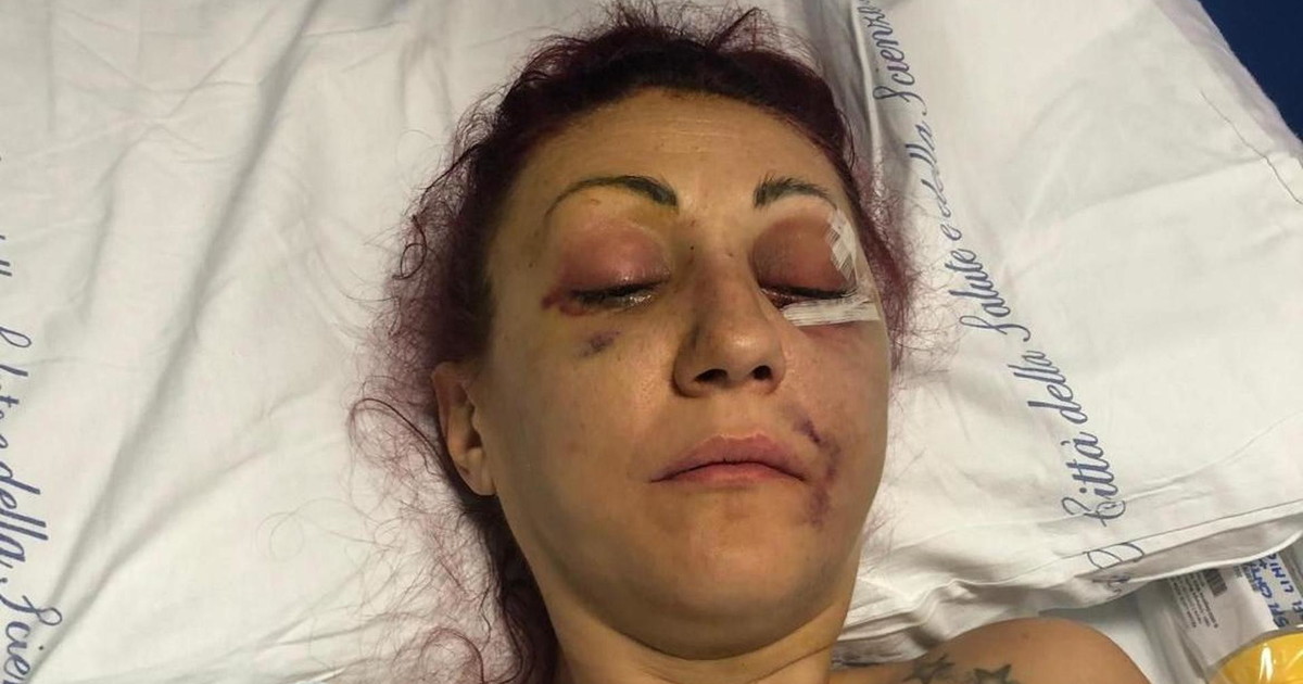 Lucia Regna massacrata dall