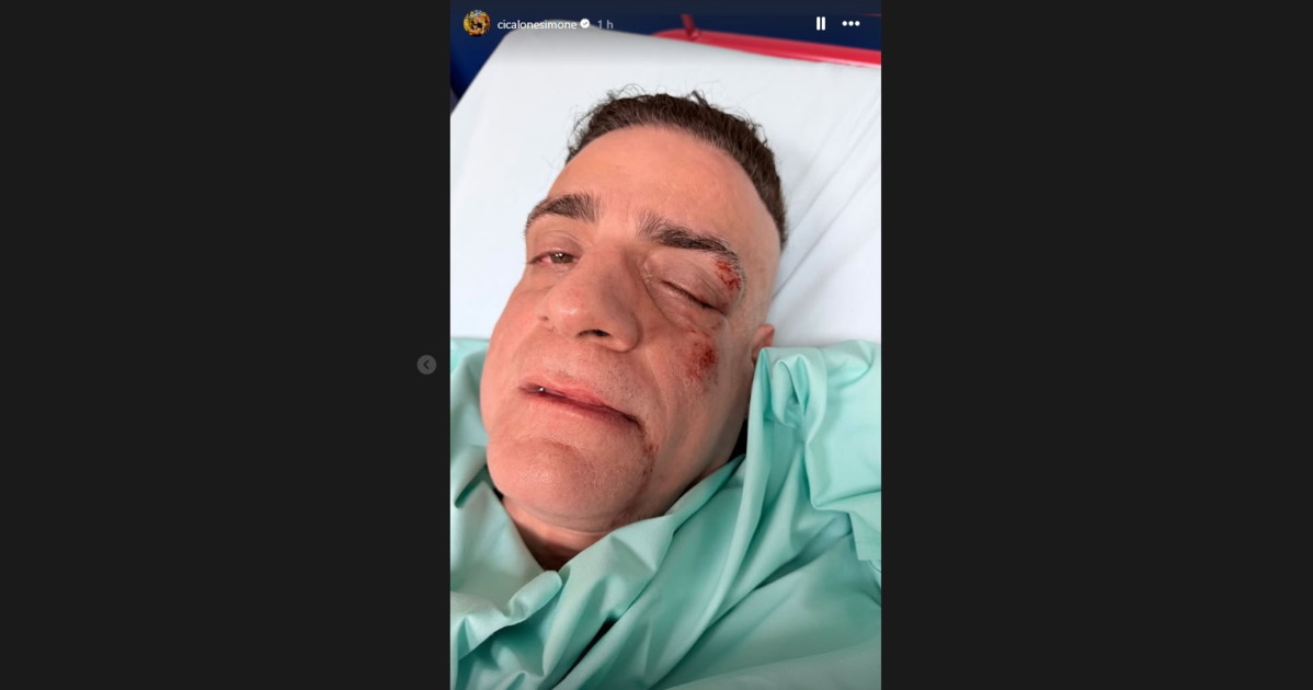 Cicalone choc, "infami veri": picchiato dai borseggiatori, com