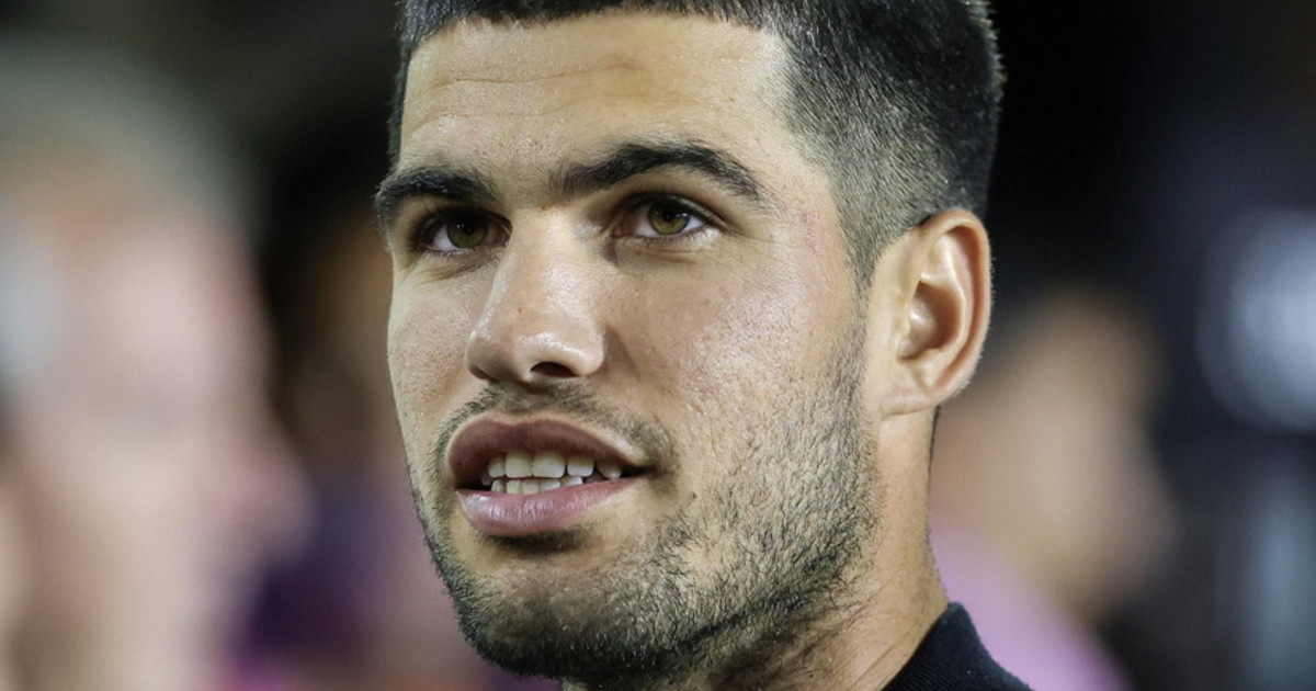 carlos alcaraz pallate in faccia da fonseca clamoroso