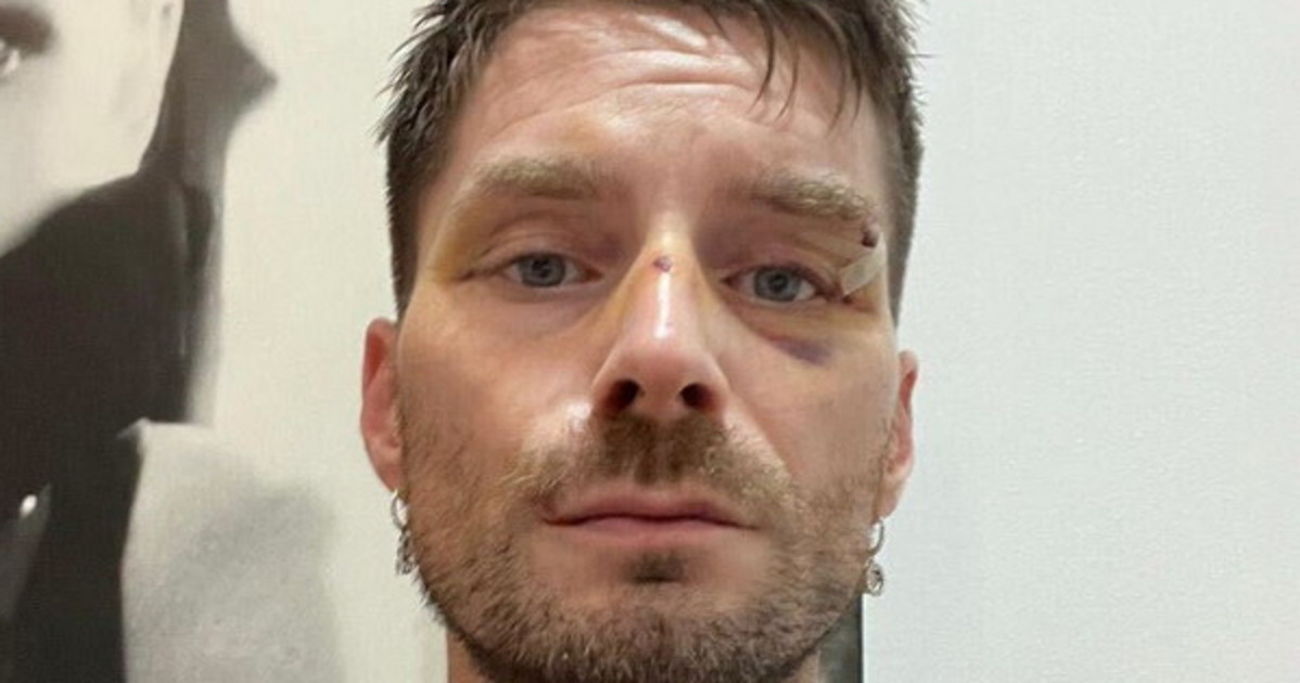 novella 2000 fame di sangue il direttore brutalmente pestato a milano da Liberoquotidiano.it novella 2000 fame di sangue il direttore brutalmente pestato a milano