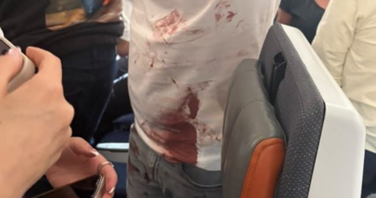volo dubai tel aviv la foto di un passeggero con la maglietta insanguinata avrebbe evitato lo schianto da Liberoquotidiano.it volo dubai tel aviv la foto di un passeggero con la maglietta insanguinata avrebbe evitato lo schianto
