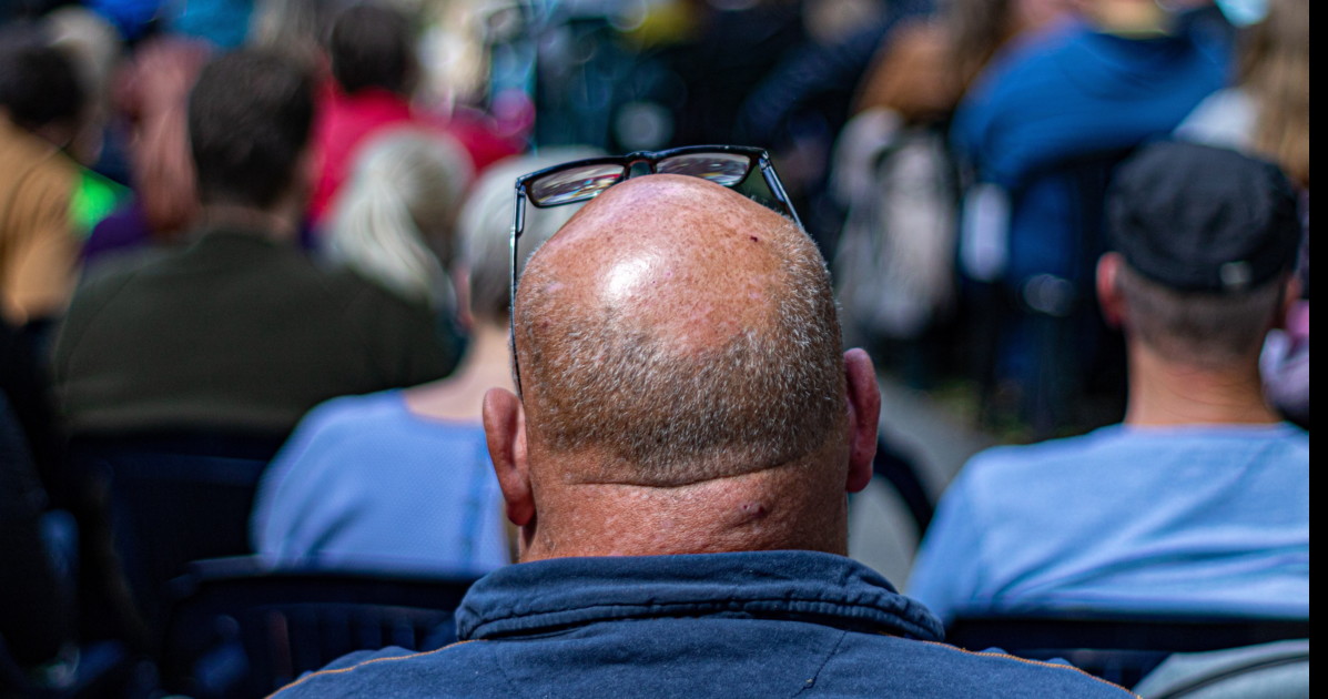 calvizie ecco i tre cibi da evitare per salvare i capelli da Liberoquotidiano.it calvizie ecco i tre cibi da evitare per salvare i capelli